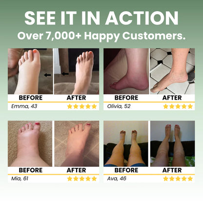 Edema Relief Miracle Balm